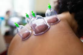 cupping